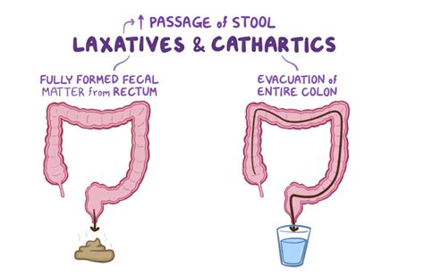 Fecal impaction often occurs in people who have had constipation for a long time and have been using laxatives. . What does moderate faecal loading mean